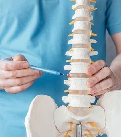 es una columna vertebral de ejemplo que muestra una hernia discal